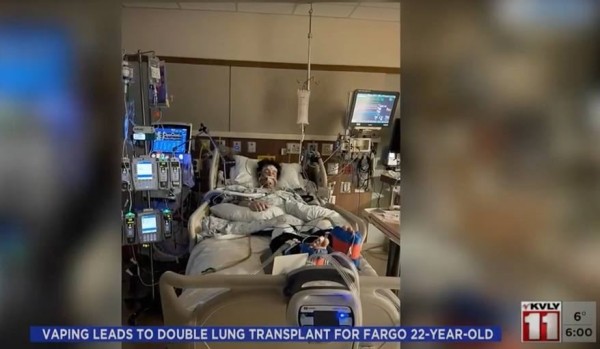 Парень постоянно курил вейп. Итог — полная пересадка легких Парень постоянно курил вейп. Итог — полная пересадка легких